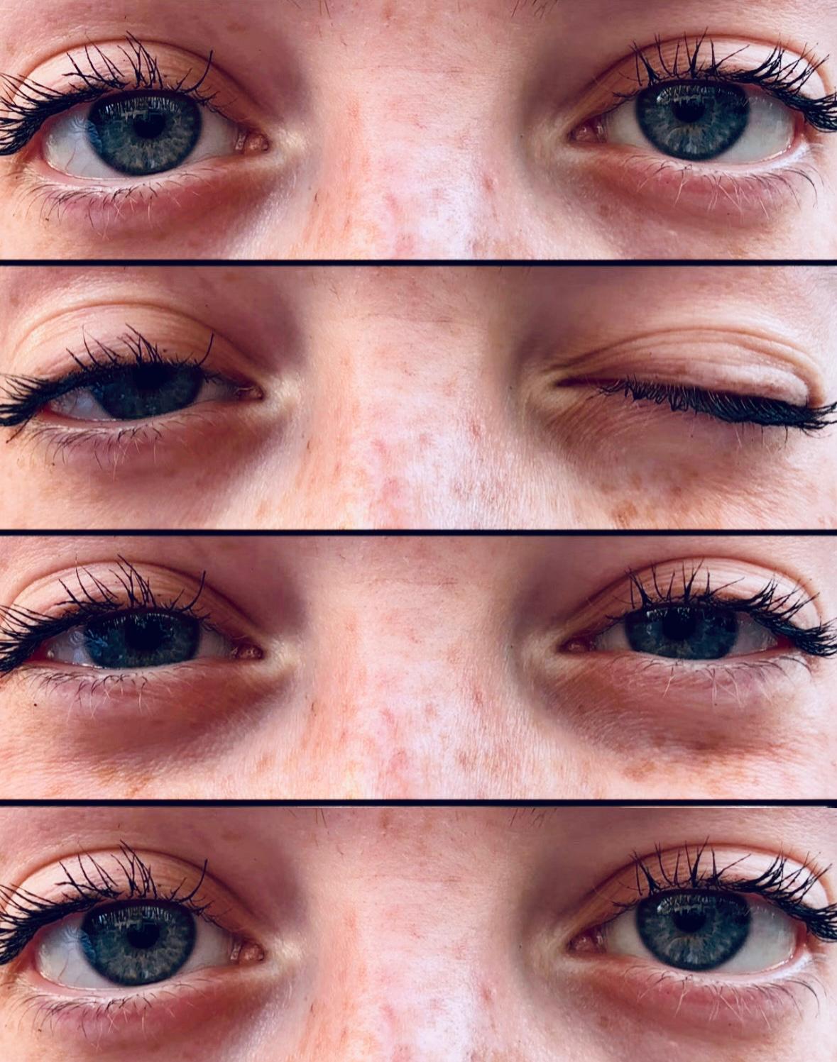 Fondo de sus ojos